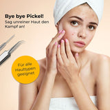 Mitesserentferner Gesichtspflege-Set Akne-Set Pflege-Set Beauty-Set